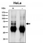 Anti-KLC1 Rabbit Monoclonal Antibody